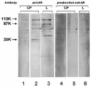 Figure  6: Western  blot  analysis  of  20μg  of  total  protein  extracted  from  male  and  female  rat  CPs, and female liver (L) using an antibody against the C-terminal region (C-19) of AR