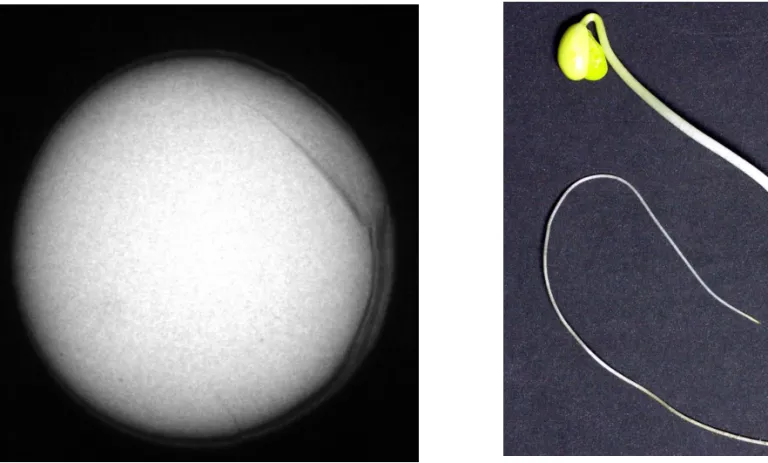 FIGURA 2. Imagem de semente obtida por meio do teste de raios X, apresentando dano severo por umidade (nota 3.3), no eixo embrionário e nos cotilédones (a), originando uma plântula anormal (b).