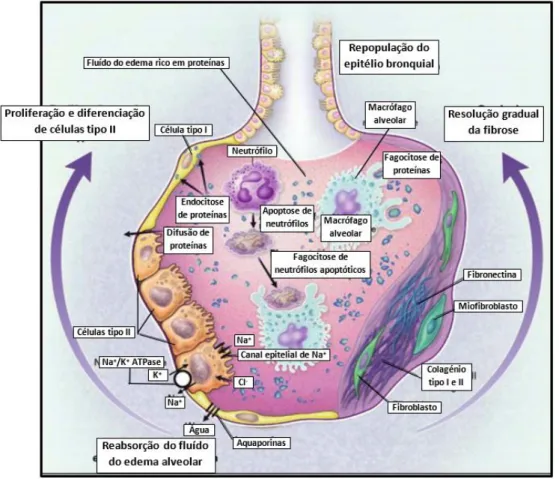 Figura  2.4  –  Mecanismos  importantes  na  resolução  da  Síndrome  de  Dificuldade  Respiratória Aguda