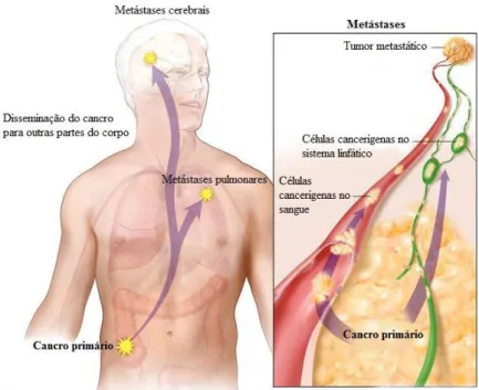 Figura 2.4 – Processo de metastização de um tumor primário. Adaptado de National  Cancer Institute [10]