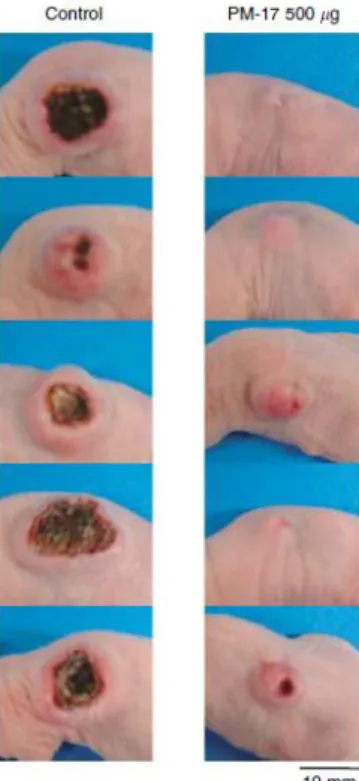 Figure  7.  Observation  of  tumour  after  41  days  of  implantation  in  nude  mice  (left  side  represents the saline control; right side represents treated mouse with PM-17) [26]