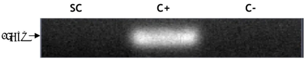 Figure 6. mRNA expression of Aquaporin 2 in rat Sertoli cells. SC: Sertoli cells; C+: positive control  (rat kidney total lysate) for Aquaporin 2; C-: control without reverse transcriptase