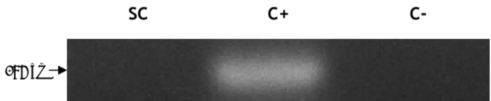 Figure 12. mRNA expression of Aquaporin 5 in rat Sertoli cells. SC: Sertoli cells; C+: positive control  (rat lung total lysate) for Aquaporin 5; C-: control without reverse transcriptase