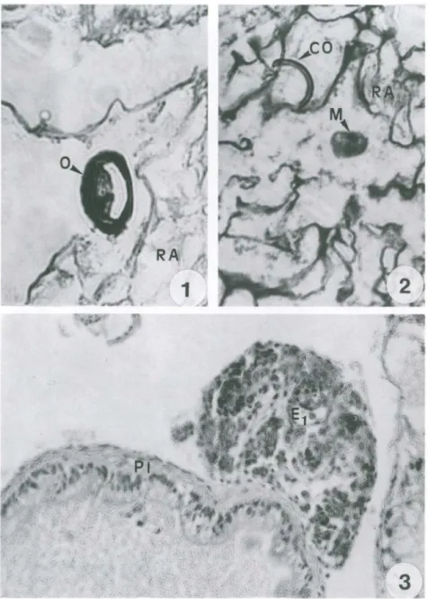 Figs  1-3.  Corte  histológico  da  região  anterior  do  trato  digestivo  de  Bradybaena  similaris  infectada  experimentalmente
