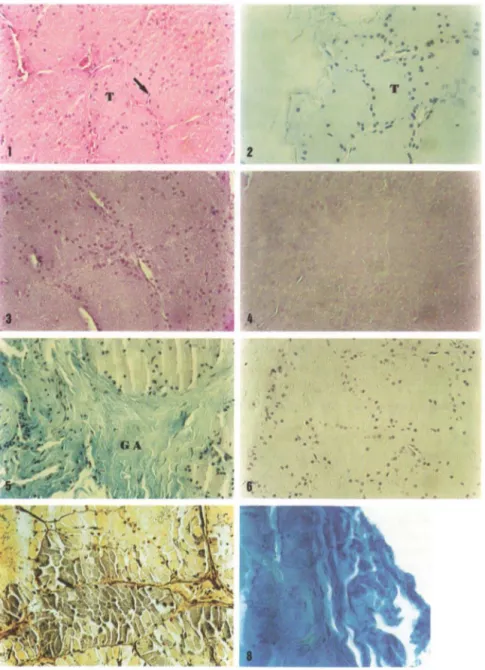 Figs  1-8. Fotomicrografia  da  glândula  de  Duvernoy  de  Clelia  plumbea . (1)  Célula  fusiforme  (seta) e túbulo  (T),  coloração: H.E.;  (2)  túbulo (T),  coloração: Azul  de  Toluidina;  (3) alta  taxa  de glicoconjudados  neutros,  técnica : PAS  +