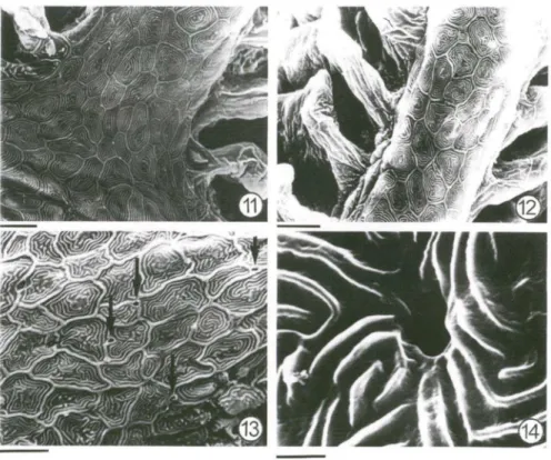 Figs  11-14.  Eletromicrografias  da  superfície  epitelial.  (11)  Vista  da  região  lateral  do  ABII  esquerdo ao nível da inserção de um filamento (notar o nitido contorno das células  pavimen-tosas e a transição das micropregas em direção às lamelas 