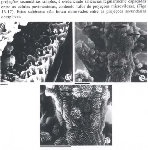 Figs  15-17.  Eletromicrografias  dos  rasteias  do  ABII  esquerdo  com  projeções  secundárias  cobertas com células pavimentosas com micropregas