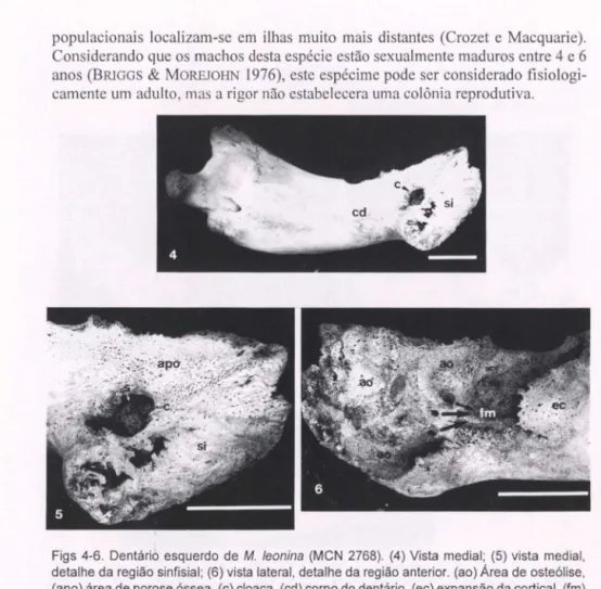 Figs  4-6.  Dentário  esquerdo  de  M.  leonina  (MCN  2768).  (4)  Vista  medial;  (5)  vista  medial,  detalhe da  região sinfisial;  (6)  vista lateral, detalhe da região anterior