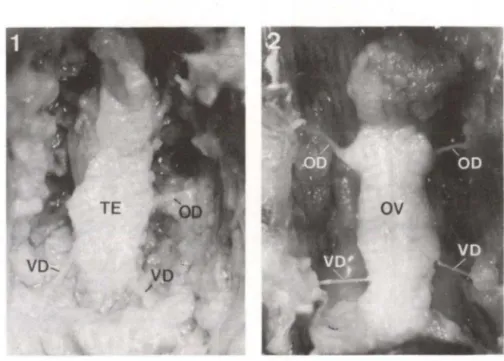 Figs  1-2.  Parastacus  brasiliensis,  vista  dorsal  da  gônada. (1)  Masculina; (2) feminina