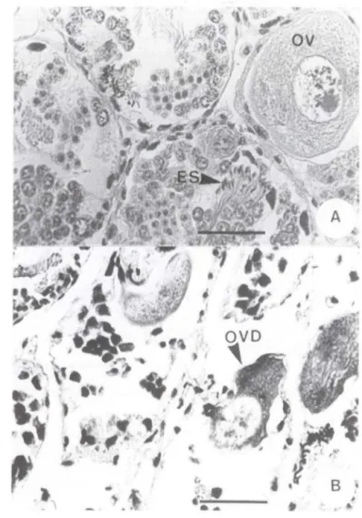 Fig . 3.  Corte  histológico  do  ovotéstis  de Bradybaena  similaris.  (A)  Espécime não-infectado,  mostrando  o  estado  perfeito  da  gónada;  (B)  espécime  infectado  experimentalmente  com  Eurytrema coelomaticum, mostrando o estado degenerativo do 