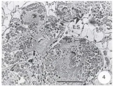 Fig.  4.  Corte  histológico  do  ovotéstis  de  um  espécime  de  Bradybaena  similaris  infectado  experimentalmente com Eurytrema coelomaticum,  mostrando que após  45  dias de infecção,  apenas a espermatogênese foi  preservada 