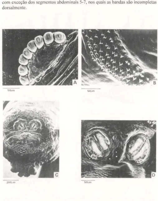 Fig.  4.  Fotomicrografia de varredura da  larva de segundo instar de Sarconesia chlorogasfer