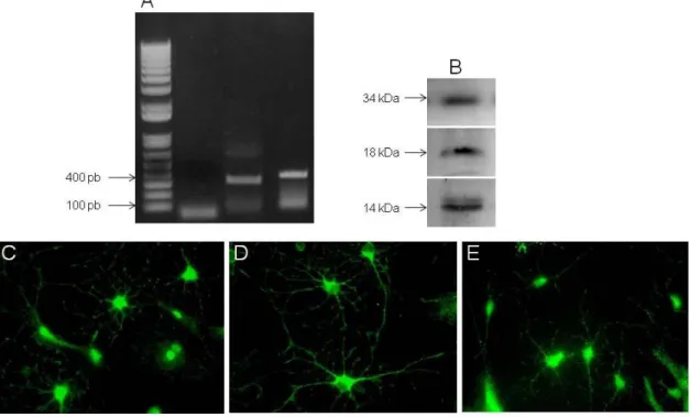 Figure 2:  Expression of GDNF, CDNF and BDNF by astrocytes. Primary astrocytes was  collect for analyze in RT-PCR, western blot and immunocytochemistry