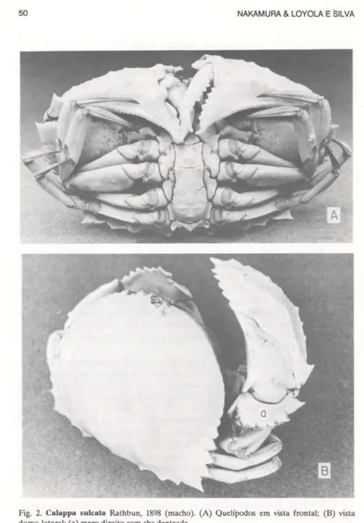 Fig. 2. CaJappa sulcata Rathbun, 1898 (macho). (A) Quelípodos em vista frontal; (B) vista dorso-lateral; (a) mero direito com aba denteada.