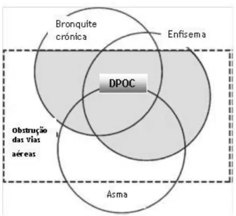 Figura  1  –  Diagrama  Clássico  de  Venn  usado  para  descrever  a  sobreposição  das  características  clínicas  e  patológicas  da  bronquite  crónica,  enfisema  e  asma