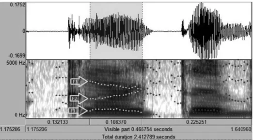 Figura 3. Forma da onda e espectrograma de uma produção alvo, da palavra “carta”