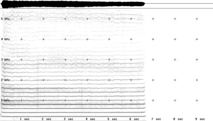 Figura 1. Espectrograma com traçado regular, intensidade fraca, estável, com ruído ausente, sub-harmônicos ausentes e harmônicos deinidos  até 3 kHz