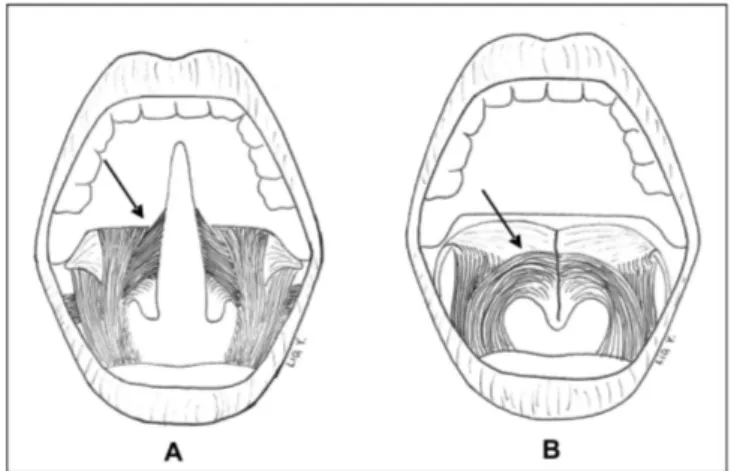 Figura 1. Representação esquemática da musculatura do palato mole. 