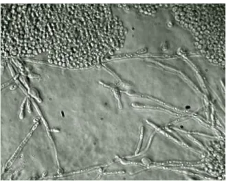 Figura 3. Candida albicans 