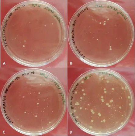 Figure  11:  YPD  plates  with  colonies  with  Pichia  pastoris  transformed  with  pPICZαB-STEAP1_6His  expression  vector;  A-  12.5  µL  of  transformed  cells;  B-  25  µL  of  transformed  cells;  C-  50  µL  of  transformed cells; D- 100 µL of trans