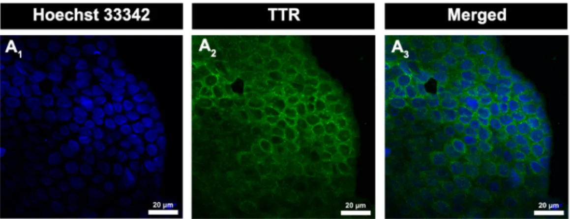 Figure 6 - Expression and localization of TTR in rat CP by confocal microscopy (A1-A3)