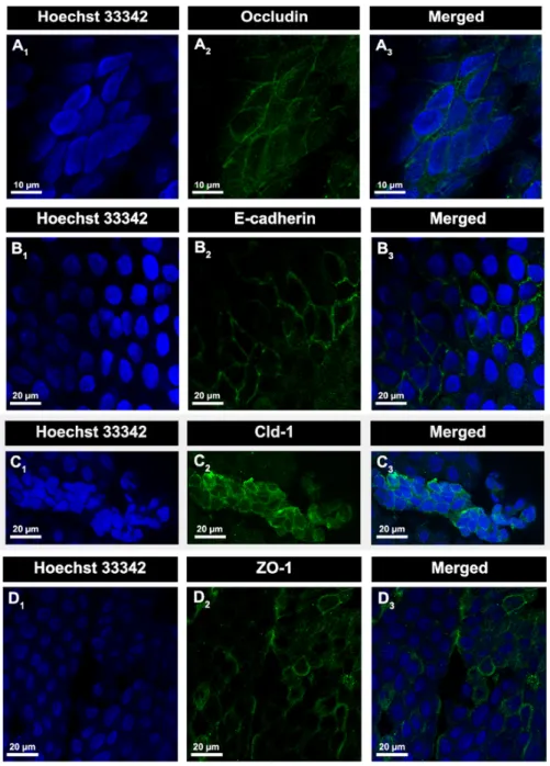 Figure 10 - Localization and expression of some TJs and AJs proteins of BCSFB, in rat CP explants, by  confocal microscopy