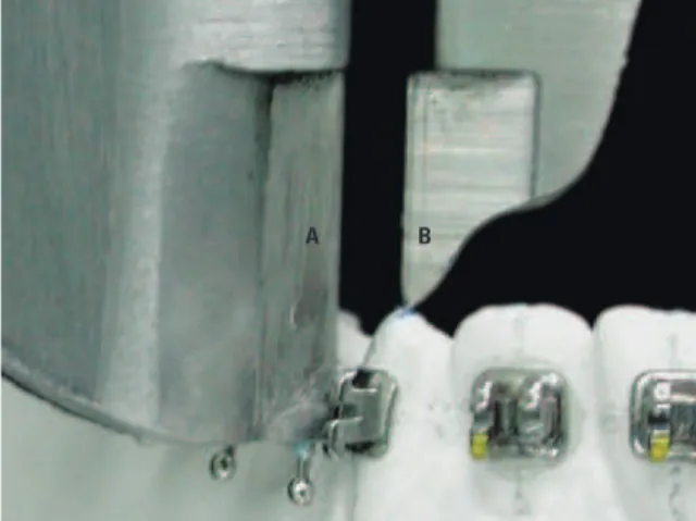 FIGURA 8 - Espaço medido pelo paquímetro entre o dente e o centro do  braquete (A – B).