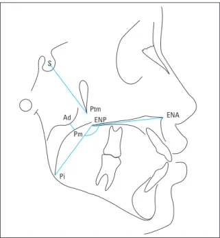 FIGURA  5  -  Cefalograma  representando  os  pontos  e  linhas  utilizados  para a determinação do espaço livre da nasofaringe.