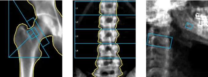 FIGURA 4 - Imagens das ROIs femural, lombar, cervical e mandibular.
