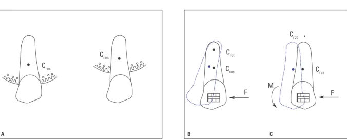 FIGURA 5 - A) Localização do centro de resistência (C res ), o qual varia em função das dimensões do meio circundante e posicionamento do centro de rotação (C rot ) B) quando o dente está sujeito a somente uma força, o que provoca sua inclinação, e C) um m