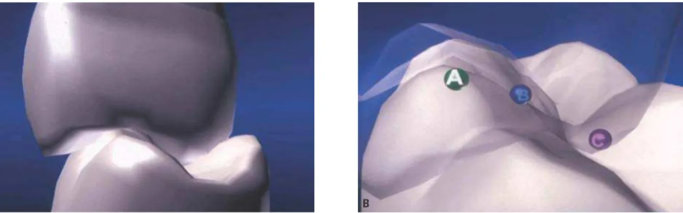 FIGURA 3 - Contatos oclusais no sentido vestibulolingual. A) Visualização da oclusão dentária no sentido vestibulolingual quando os dentes estão bem posicionados em  suas bases ósseas