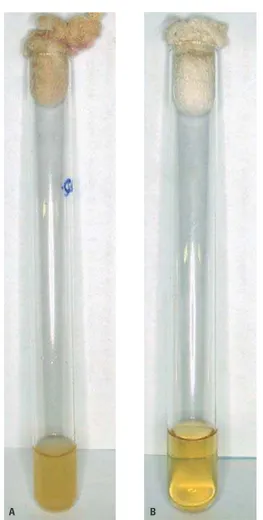 FIGURA 5 - Teste de viabilidade de Bacillus stearothermophilus em alicates  esterilizados, após coleta em swabs nos tempos pré-determinados