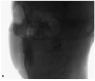 FIGURA 15 - Imagens base da cabeça do paciente, geradas durante o exame de TC de feixe cônico - raw data (de FARMAN; SCARFE 13 ).