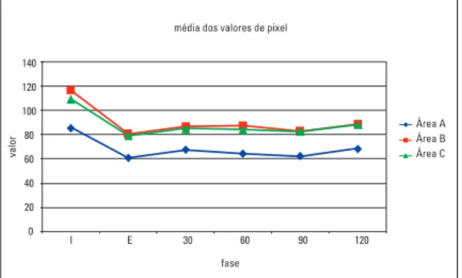 GRÁFICO  2  -  Representação  gráfica  das  médias  dos  valores  de pixels  das  áreas A, B e C nas fases inicial (I), pós-expansão (E) e contenção de 30, 60, 90  e 120 dias, dos grupos feminino e masculino.