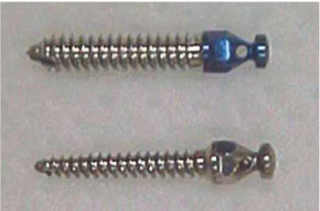 FIGURA 3 - Aparelho ortodôntico completo.  FIGURA 4 - Mini-implantes para ancoragem ortodôntica.