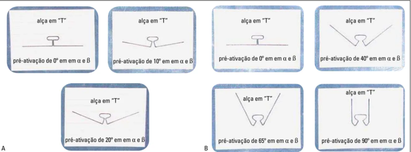 FIGURA 3 - Gabaritos em papel milimetrado para padronização da confecção e pré-ativação das molas “T” (G1) e “T” com helicóides (G2)