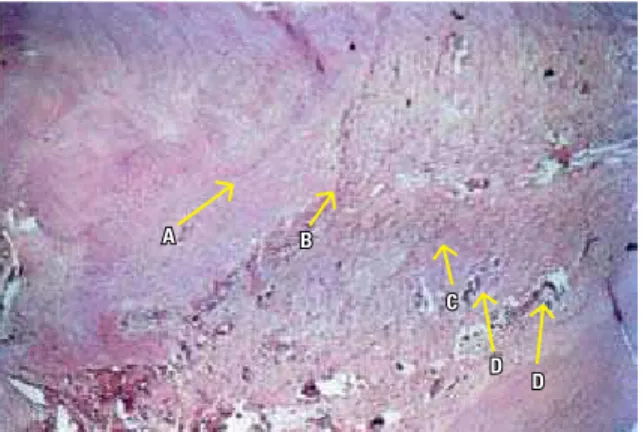 FIGURA 9A - Coloração H.E. Aumento S40x. A) Fibras distendidas e densiseri- densiseri-das; B) Nichos de reabsorção no tecido ósseo; C) Cementoblastos dispostos  regularmente; D) Osteócitos.