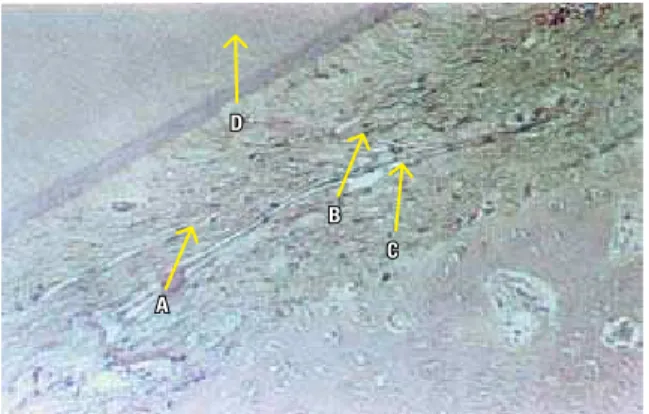 FIGURA 10B - Coloração T.M. Aumento S10x. A) Osteoblastos; B) Reorganiza- Reorganiza-ção das fibras; C) Tecido ósseo regular; D) Fibroblastos jovens.