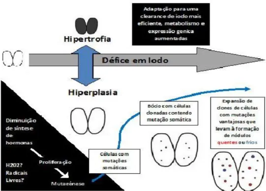 Figura  1.  Hipótese  para  transformação  nodular  da  tiróide.  O  ponto  de  partida  é  a  hiperplasia  induzida  por  um  estímulo goitrigénio (exemplo: défice em iodo)