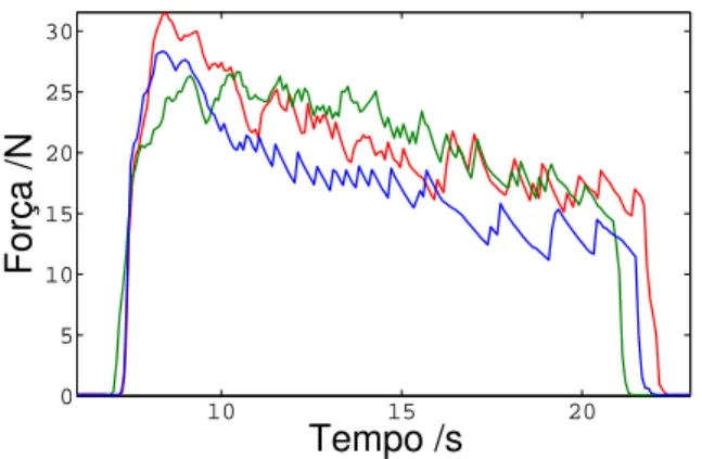 Figura 7: Teste cl´ınico objetivo em paciente levemente hipo- hipo-tenso (em azul) em compara¸c˜ ao a dois pacientes normotensos.