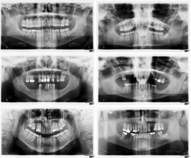 Figure 3.2: Examples of images of the Dental X-ray data set.
