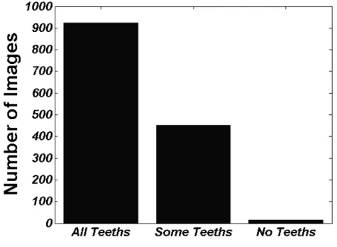 Figure 3.3: Number of images concerning the quantity of teeth per mouth.