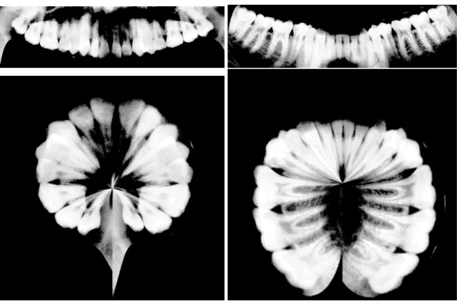 Figure 5.7: The resulting polar coordinates transformation for each separated jaw.