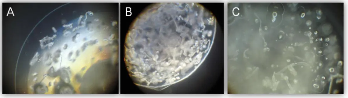 Figure  4.5  shows  the  encapsulated  PLLA  microparticles  with  cells  seeded  onto