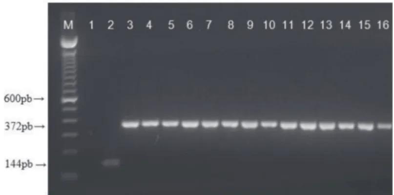 FIGURA 1 -  Produtos de ampliicação da PCR-multiplex  para ilotipagem dos isolados de Ralstonia solanacearum