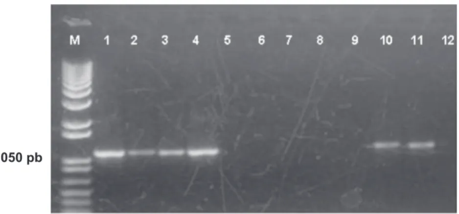 FIGURA  1  - Peril eletroforético dos produtos de PCR com os oligonucleotídeos iniciadores A1/B6 utilizando diferentes métodos de  extração de DNA do isolado patogênico Pack9, em cultura pura ou na presença de macerado de gemas de pereiras europeias: M, ma
