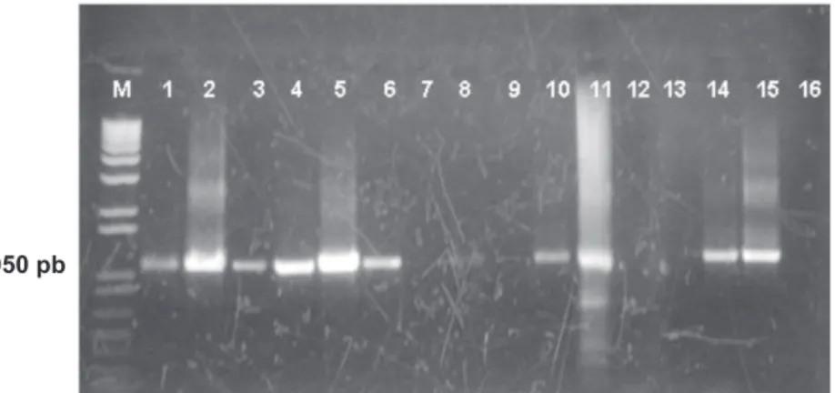 FIGURA 2 -  Peril eletroforético dos produtos de PCR com os oligonucleotídeos iniciadores A1/B6, utilizando diferentes métodos de  extração de DNA, em cultura pura ou na presença de macerado de gemas de pereiras europeias: M, marcador de peso molecular 1 K