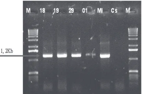 FIG.  1  -  Ampliicação  do  16S  rDNA  (1,2  kb)  do  itoplasma  encontrado  em  amostras  de  plantas  de  cana-de-açúcar  com  a  síndrome  do  amarelecimento foliar