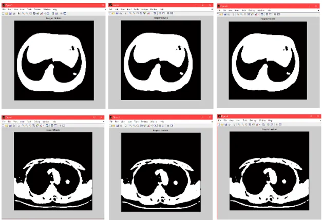 Figura 9 - Exemplo dos filtros utilizados na Segmentação [imagens de própria autoria].