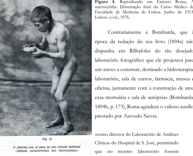Figura  4.  Reproduzido  em  Ernesto  Roma,  A  microcefalia.  Dissertação  final  do  Curso  Médico  da  Faculdade  de  Medicina  de  Lisboa